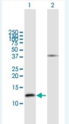 Western Blot: GNRH2 Antibody [H00002797-B01P-50ug]