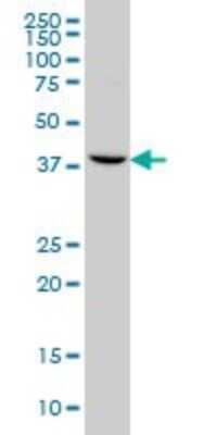 Western Blot: GNRHR2 Antibody (4A5) [H00114814-M01]
