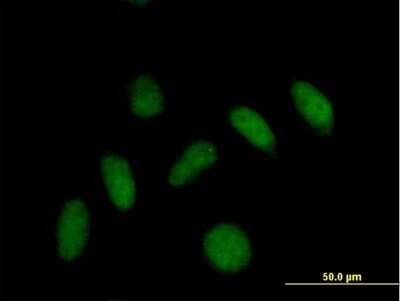 Immunocytochemistry/ Immunofluorescence: GNRPX Antibody [H00055111-B01P]