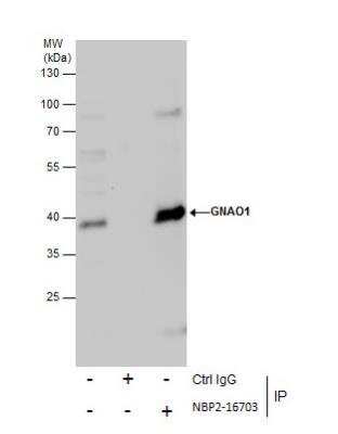 Immunoprecipitation: GO Protein alpha Antibody [NBP2-16703]