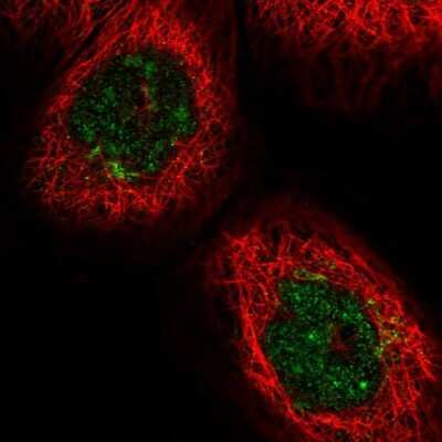 Immunocytochemistry/ Immunofluorescence: GOLGA3 Antibody [NBP1-91953]