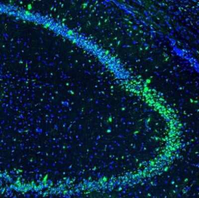Immunohistochemistry: GOLGA5 Antibody [NBP1-83352]