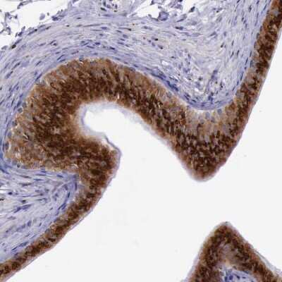 Immunohistochemistry-Paraffin: GOLGA5 Antibody [NBP1-83352]