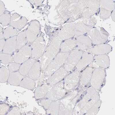 Immunohistochemistry-Paraffin: GOLGA5 Antibody [NBP1-83352]