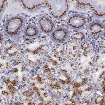 Immunohistochemistry-Paraffin: GOLGA5 Antibody [NBP1-83352]