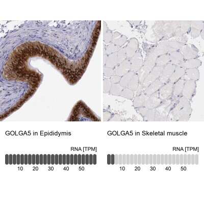 Immunohistochemistry-Paraffin: GOLGA5 Antibody [NBP1-83352]