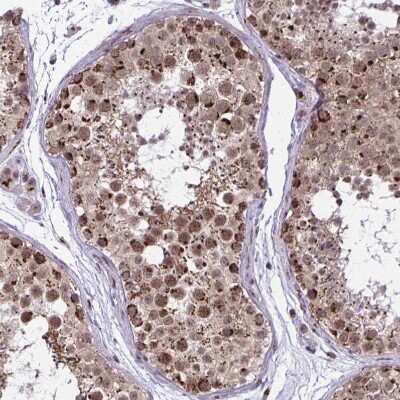 Immunohistochemistry-Paraffin: GOLGA5 Antibody [NBP2-39007]