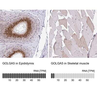 Immunohistochemistry-Paraffin: GOLGA5 Antibody [NBP2-39007]