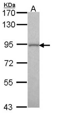 Western Blot: GOLGA5 Antibody [NBP1-31862]