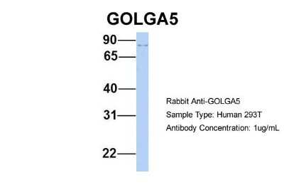 Western Blot: GOLGA5 Antibody [NBP1-60047]
