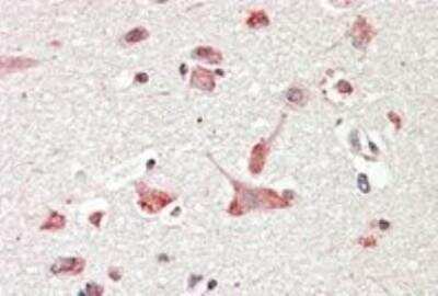 Immunohistochemistry-Paraffin: GOLGA6 Antibody [NB100-2436]