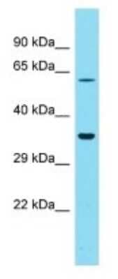 Western Blot: GOLGA6L4 Antibody [NBP3-09728]