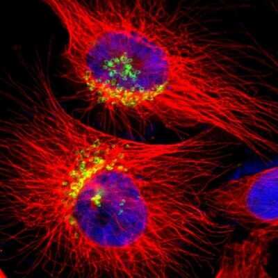 Immunocytochemistry/ Immunofluorescence: GOLGB1/Giantin Antibody [NBP1-91937]