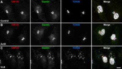 Immunocytochemistry/ Immunofluorescence: GOLGB1/Giantin Antibody [NBP2-22321]