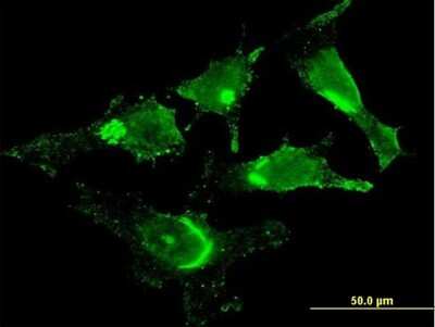 Immunocytochemistry/ Immunofluorescence: GOLM1 Antibody (5B10) [H00051280-M06]