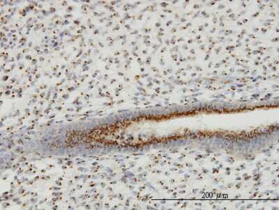 Immunohistochemistry-Paraffin: GOLM1 Antibody (5B10) [H00051280-M06]