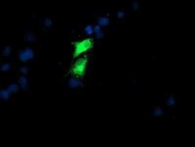 Immunocytochemistry/ Immunofluorescence: GOLM1 Antibody (OTI4B12) - Azide and BSA Free [NBP2-71916]