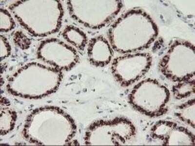 Immunohistochemistry: GOLM1 Antibody (OTI4B12) - Azide and BSA Free [NBP2-71916]