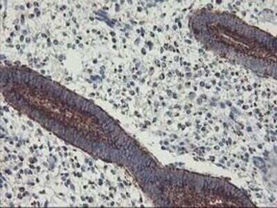Immunohistochemistry: GOLM1 Antibody (OTI4B12) - Azide and BSA Free [NBP2-71916]
