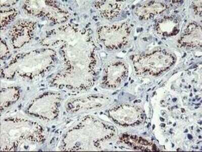 Immunohistochemistry: GOLM1 Antibody (OTI4B12) - Azide and BSA Free [NBP2-71916]