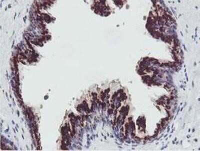 Immunohistochemistry-Paraffin: GOLM1 Antibody (OTI4B12) [NBP2-01639]