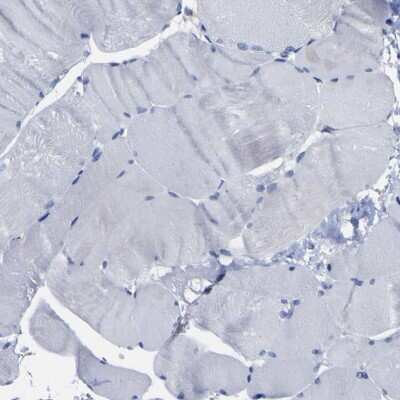 Western Blot: GOLM1 Antibody [NBP1-88774]