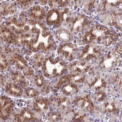 Immunohistochemistry: GOLPH3 Antibody [NBP1-81804]