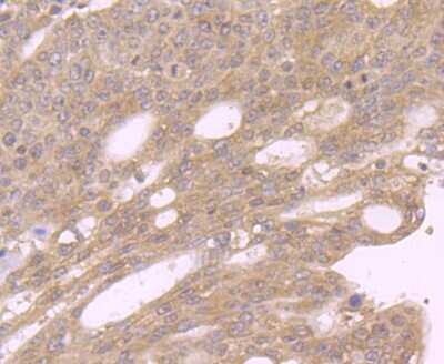Immunohistochemistry-Paraffin: GOLPH3 Antibody [NBP2-75515]