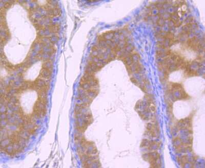 Immunohistochemistry-Paraffin: GOLPH3 Antibody [NBP2-75515]