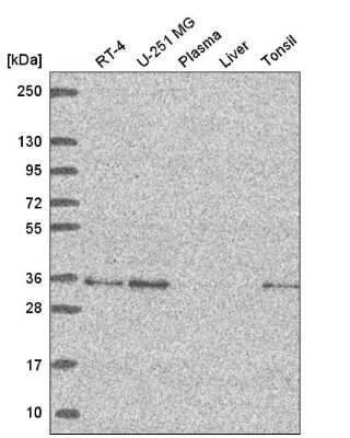 Western Blot: GOLPH3 Antibody [NBP2-58286]