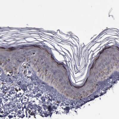 Immunohistochemistry-Paraffin: GOLPH4 Antibody [NBP1-91955]