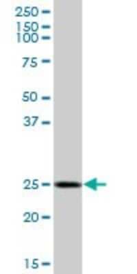 Western Blot: GOSR1 Antibody [H00009527-B01P]