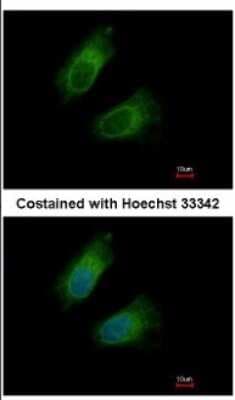 Immunocytochemistry/ Immunofluorescence: GOT2 Antibody [NBP2-16708]