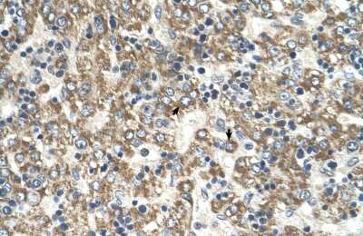 Immunohistochemistry-Paraffin: GOT2 Antibody [NBP1-80521]
