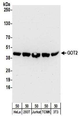 Western Blot: GOT2 Antibody [NBP2-32241]