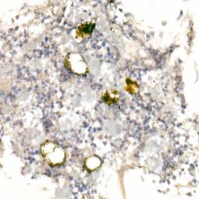 Immunohistochemistry-Paraffin: GP-IX Antibody - Azide and BSA Free [NBP3-03507]