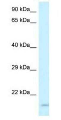 Western Blot: GP-IX Antibody [NBP1-79895]