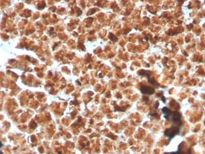 Immunohistochemistry-Paraffin: GP2 Antibody (GP2/3134R) - Azide and BSA Free [NBP3-08243]