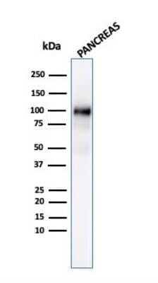 Western Blot: GP2 Antibody (GP2/3134R) [NBP3-07339]