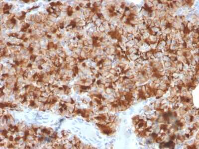 Immunohistochemistry-Paraffin: GP2 Antibody (GP2/3416) - Azide and BSA Free [NBP3-08216]