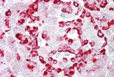 Immunohistochemistry: GP2 Antibody [NBP1-59912]