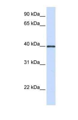 Western Blot: GP2 Antibody [NBP1-59912]