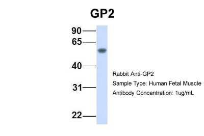 Western Blot: GP2 Antibody [NBP1-59912]