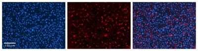 Immunohistochemistry: GPAA1 Antibody [NBP1-62435]