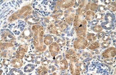 Immunohistochemistry-Paraffin: GPAA1 Antibody [NBP1-62435]