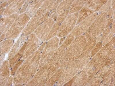 Immunohistochemistry-Paraffin: GPAA1 Antibody [NBP2-16709]