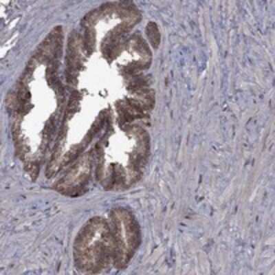 Immunohistochemistry-Paraffin: GPAA1 Antibody [NBP3-17254]