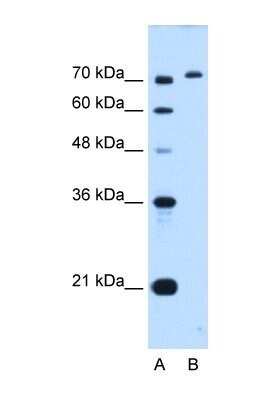 Western Blot: GPAA1 Antibody [NBP1-62435]