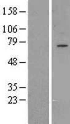 Western Blot: GPAA1 Overexpression Lysate [NBL1-11213]