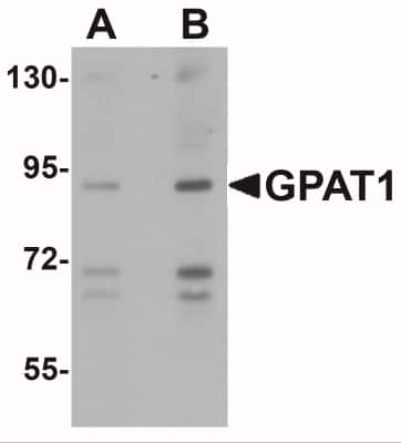 Western Blot: GPAM AntibodyBSA Free [NBP1-76907]